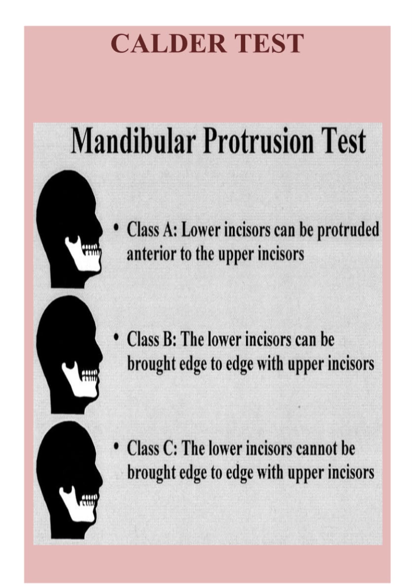 Mandibular protrusion (Calder) test, classes A, B and C