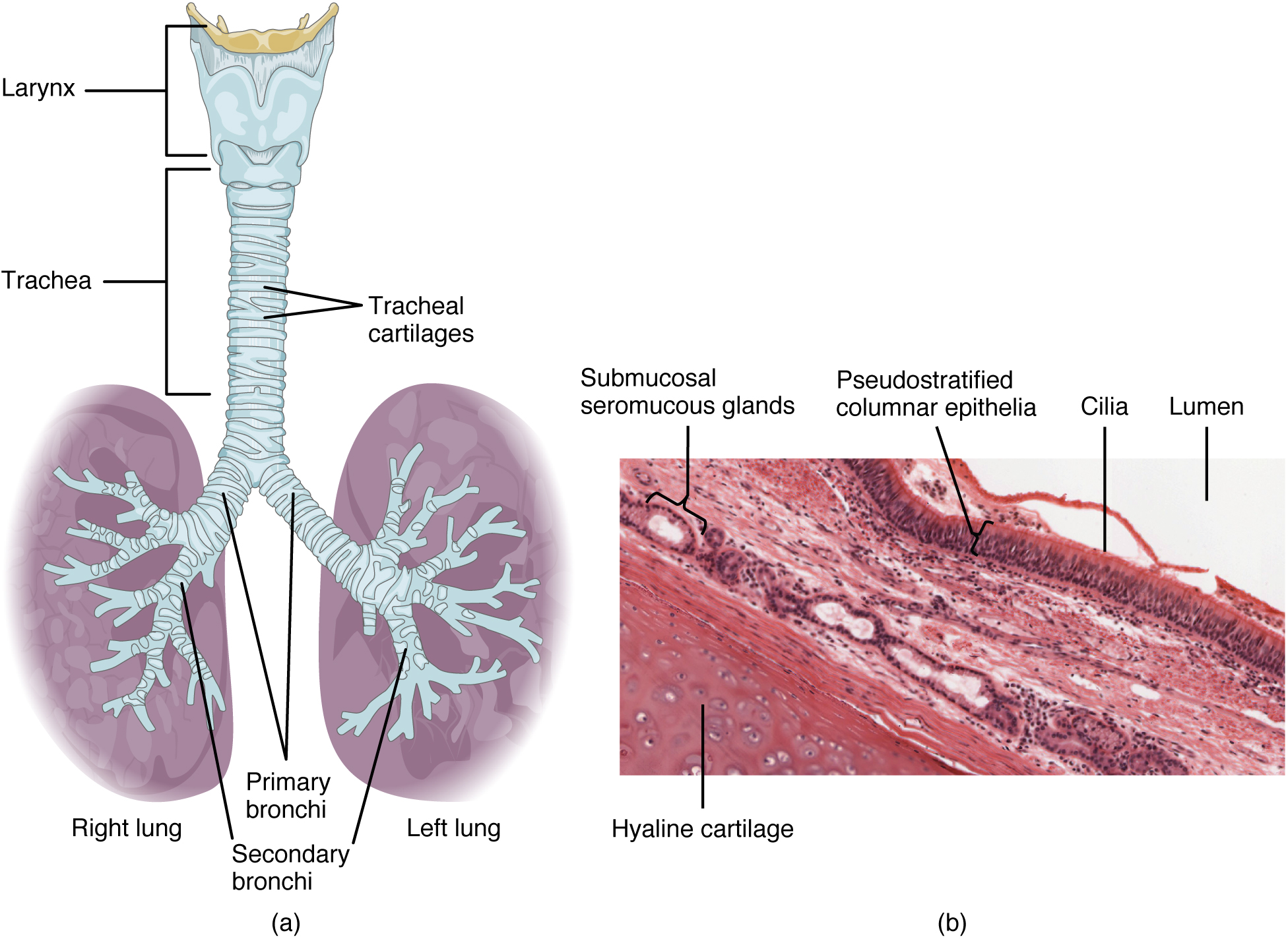 Larynx, trachea, carina and the primary and secondary bronchi, with the more vertical right main bronchus