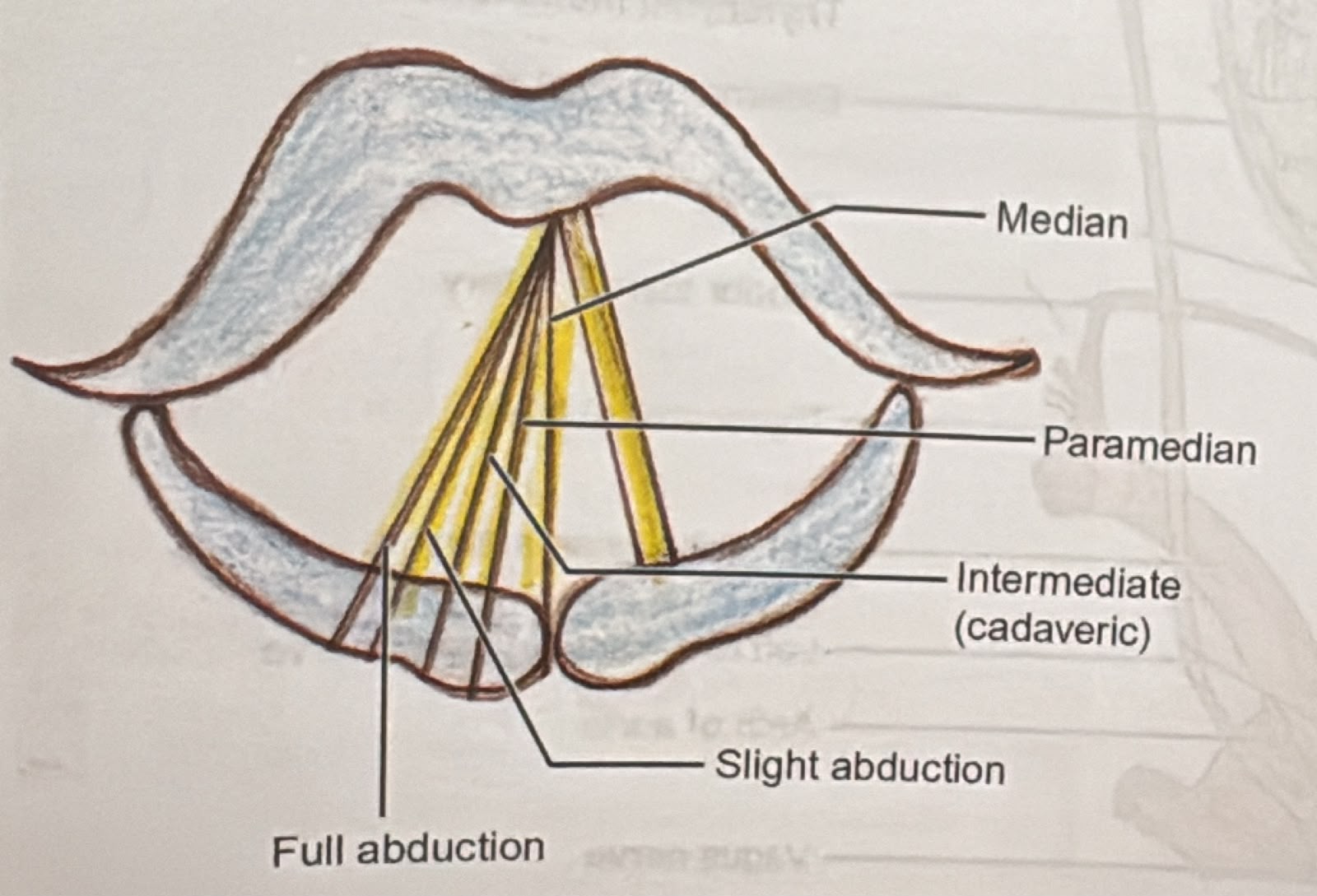 Superior view of the glottis with the vocal cord shown at five positions: median, paramedian, intermediate or cadaveric, slight abduction and full abduction